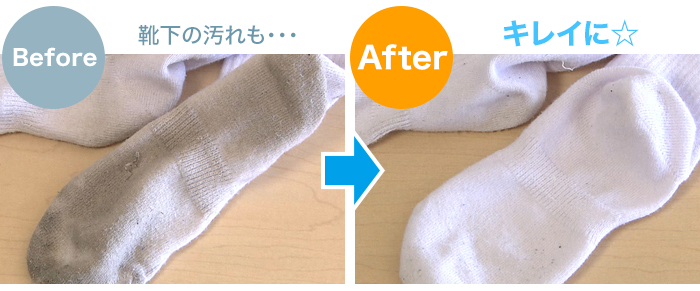 「靴下ビフォーアフター」